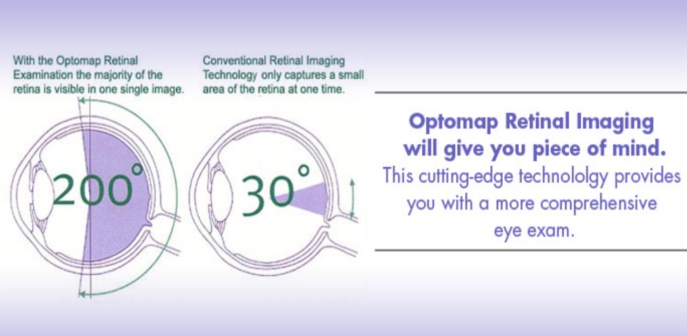 Eye Care WestGlen Eye Care